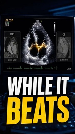 Only One Scan Sees Your Heart Beat Live