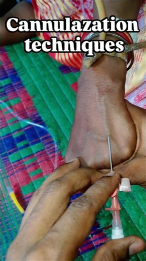 IV Cannulation Techniques | Step by Step Procedure | Nursing Skills & Clinical Practice #cannulation