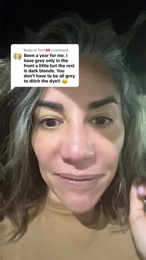 Exploring Unique Gray Hair Patterns in Women