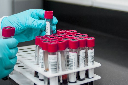 A Faster, Better Way to Diagnose Lyme Disease | Clinical And Molecular Dx