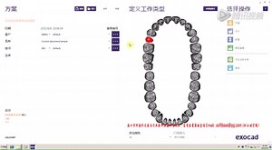 牙科CAD&CAM系统ExoCad基本版可设计冠、桥