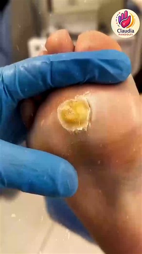 122K views · 1.2K reactions | Ep.845 Budget-friendly ideas for smart meal planning  #SmartEating #HeartHealthyDiet #BudgetEating | Claudia Pandolfi | Facebook