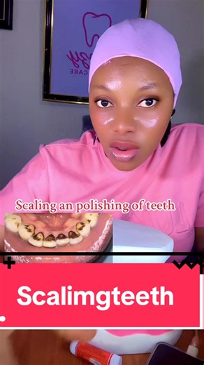 Teeth Scaling and Polishing: What You Need to Know