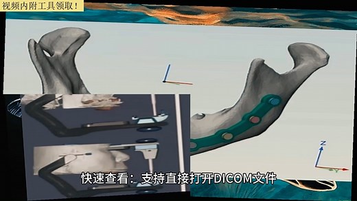 dicom文件是什么意思？dcm用什么软件可以打开？radiant dicom viewer安卓版？