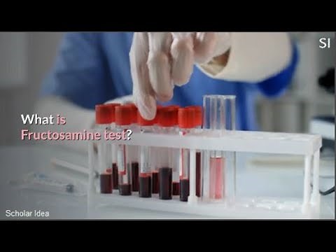 What is Fructosamine test?