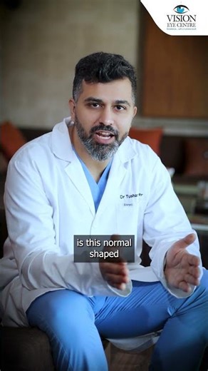 Keratoconus Explained: Early Signs to Watch For #shorts #keratoconus #eyehealth