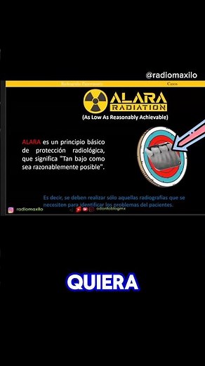 ALARA Principle #shorts #alara #alaraprinciple #radiology #dentistry #radiation