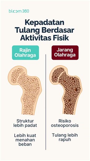 Kepadatan Tulang Berdasarkan Aktivitas Fisik