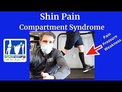 Shin Pain from Compartment Syndrome (Shin pain with running)