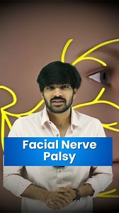 658K views · 64 comments | 易 UMN vs LMN Facial Palsy — Explained in...