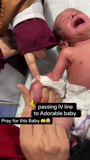 Passing IV Line to Miracle Baby