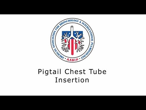 Percutaneous Chest Tube Insertion - Pigtail Catheter