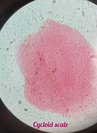 #Scales Of Fish | Placoid Scale | Ctenoid Scale| Cycloid Scale🐠🐋🐟