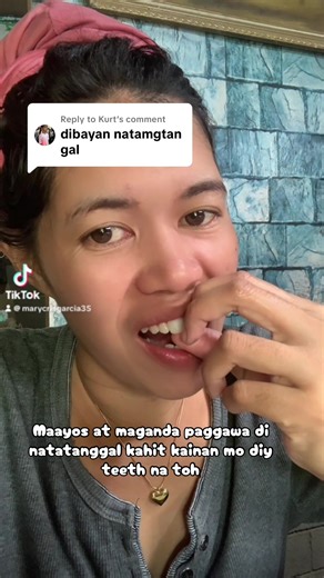 DIY Moldable False Teeth: A Simple Guide