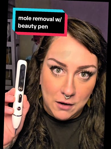 Effective Mole and Skin Tag Removal with a Beauty Pen