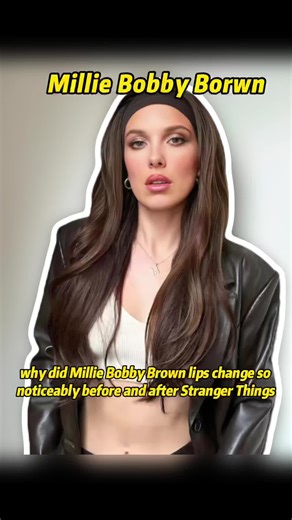 Why did Millie Bobby Brown lips change so noticeably before and after Stranger Things?#MillieBobby Brown #trending #foryou