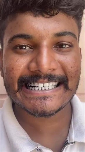 Yellow Teeth Se Pareshan? Ye Charcoal Trick Dekho!