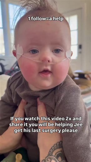 At seven months old, Jack has already endured more than many face in a full lifetime. Born with complex heart defects and intestinal malrotation, he relies on a G-tube for nourishment. Because of intense reflux, he receives continuous feedings 20 hours a day. His short journey has already included three major heart surgeries and five separate chest openings. He has even survived two cardiac arrests, one of which was stabilized through emergency medication. #babies #help #savebabies #babiesofinst
