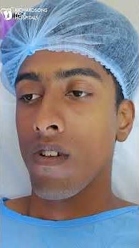 Jaw Surgery Before & After | Amazing Results