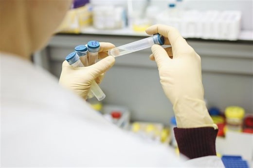 Jika Hasil Tes Antigen Positif, Apakah Harus Melakukan Tes PCR? Ini Jawaban Kemenkes - Bobo