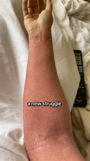 VST_FCS20_Weather_Changes