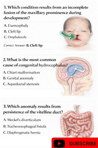 Embryology quiz