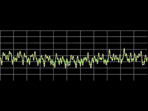 Kidney Diseases - Rife Frequencies