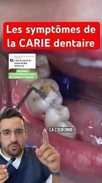 Carie dentaire : comment la repérer avant qu’il ne soit trop tard ? 🦷🔎