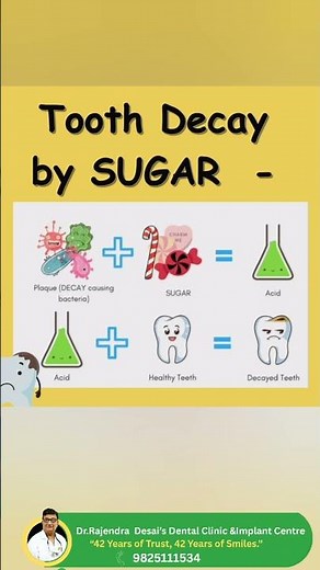 **Dental Decay Explained: Early Signs, Causes & Prevention | Must-Watch Dental Tips** #dentist