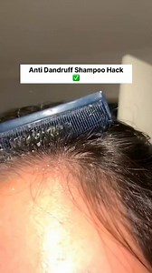 8.6K views · 20 reactions | Get Rid Of Dandruff In One Day | Dandruff Removal With This Simple Home Remedy, Hair Care Tips #haircare #dandruff #dandrufftreatment #dandruffremoval #shinehair #viralvideoシ | Health Beauty Treat | Facebook