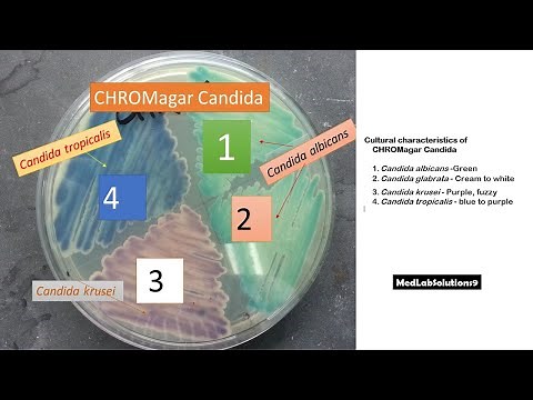Candida albicans, Candida krusei and Candida tropicalis colony morphology on Candida Chromagar