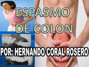 ESPASMO DE COLON. Contracciones espontáneas del músculo del colon.