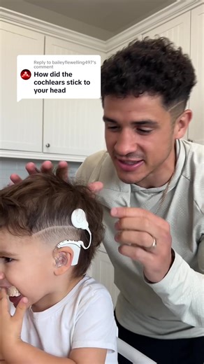 Magic of Cochlear Implants: The Sound of Magnets