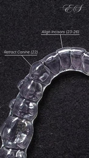 Watch Invisalign in action | Envy Smile Brooklyn, NY