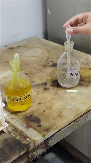 Creatinine Test Procedure | Jaffe Method | Kidney Function Test (KFT)#creatinine