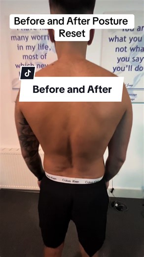 Posture Reset Benefits: Before and After Treatment