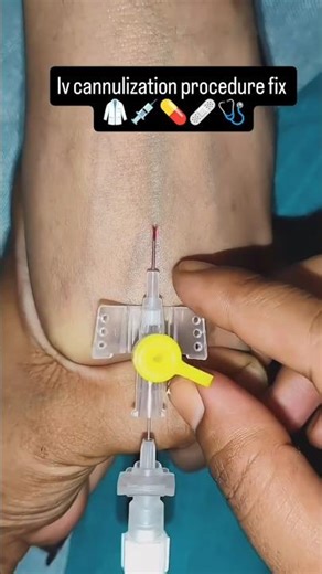 IV Cannulization Procedures Fix | Nursing Training | Nursing Toli | #nursing #doctor #cannula #mbbs