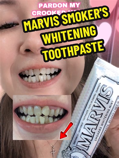 Marvis Smokers Whitening Toothpaste Review and Results