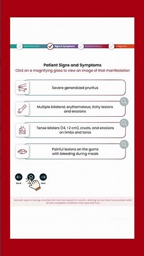 Diagnosis of Bullous Pemphigoid Interactive Patient Case