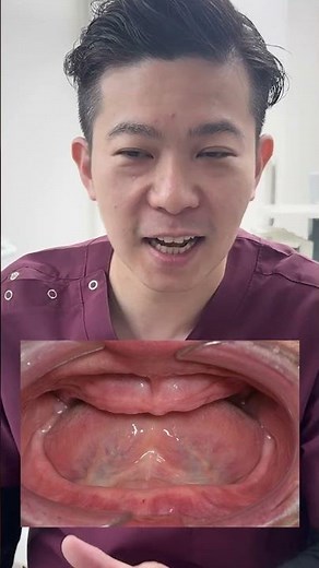 Even dentures covered by insurance can be treated this beautifully! [Dentist]