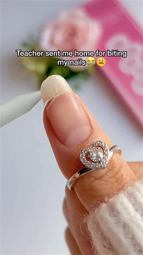 107K views · 8.5K reactions | Teacher sent me home for biting my...