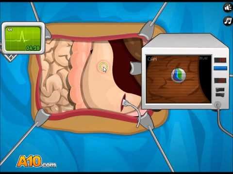 Operate Now: Stomach Surgery