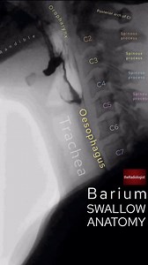 1.9K views · 49 reactions | ‍With newer more capable tests coming...