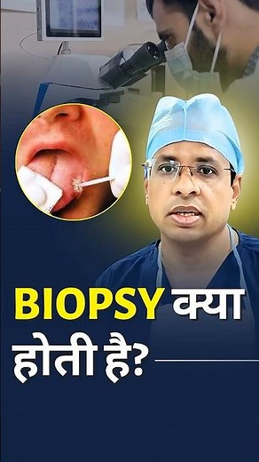 Mouth Cancer Test Explained! #drsumitshah #cancer #cancertreatment #mouthcancer #mouthbiopsy #shorts