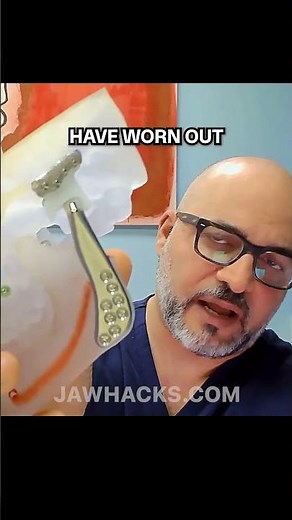 Dr. Movahed shows the design and explains the durability of total TMJ replacement.