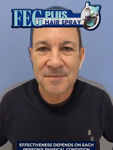 FEG Plus Hair Serum Official على TikTok