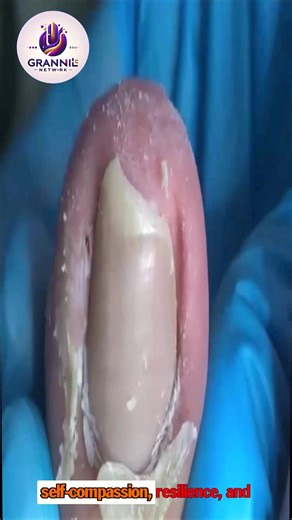 8.5K views · 50 reactions | US Foot Health: Smart Nail Practices for Elderly Feet  #USAHealth #FootHealthTips #SeniorWellness | Grand15 | Facebook