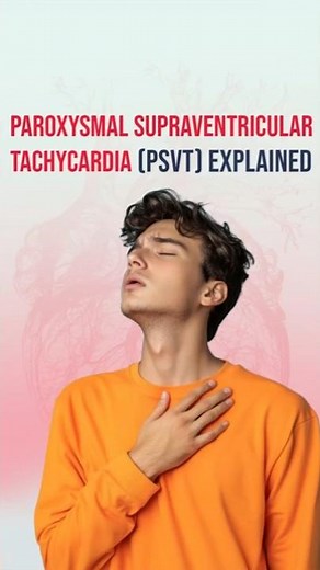 PSVT Explained: Why Your Heart Suddenly Beats So Fast