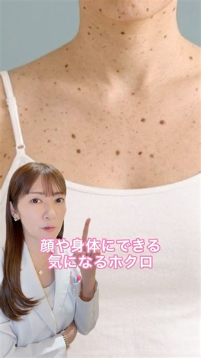 顔や体の黒い点、ほくろ。皮膚科での診断と治療法を解説。