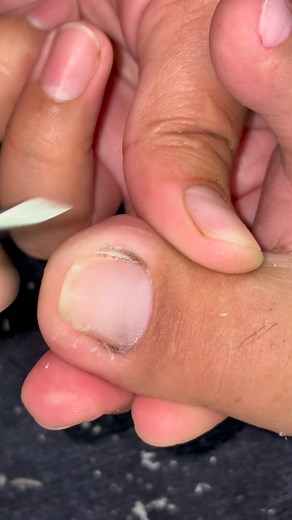 Satisfying dryskin removal | Ennah Jane Ruta Jordan